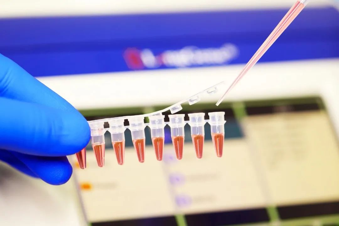 Kuidas valida PCR/qPCR tarvikuid?